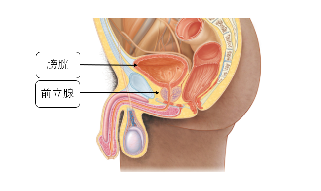 高リスク前立腺がんの種類