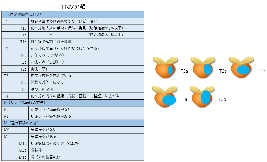 TNM分類