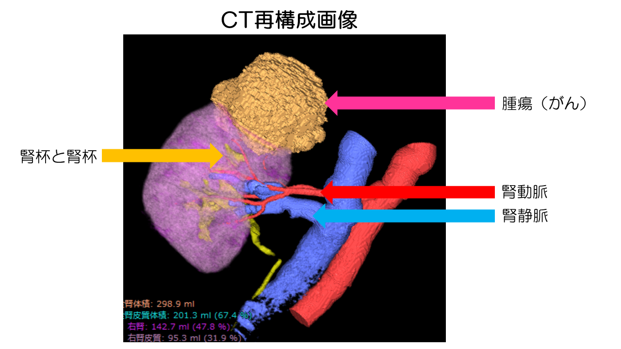 CT再構成画像