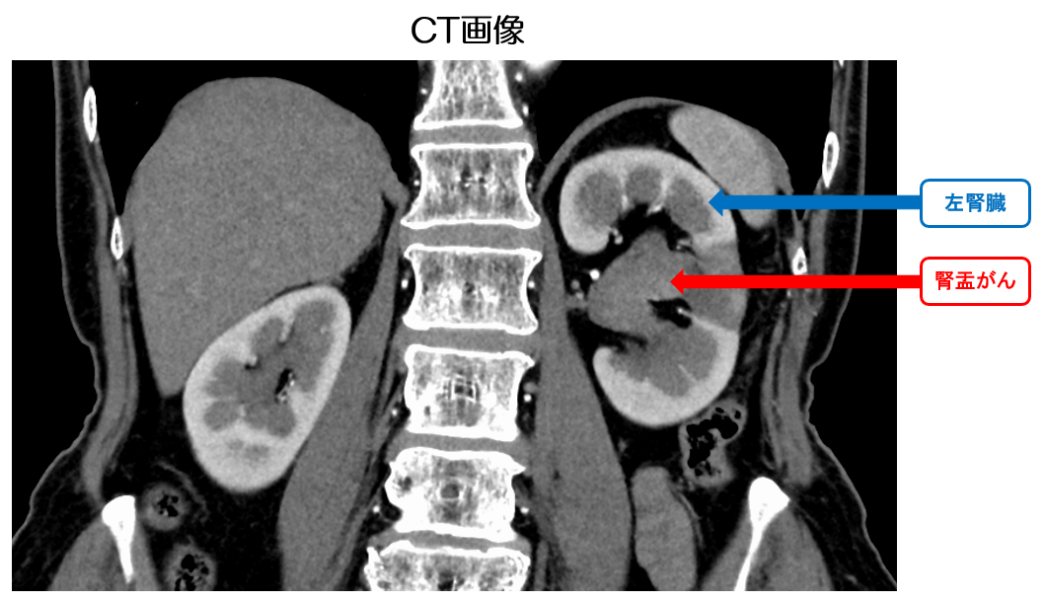 CT画像