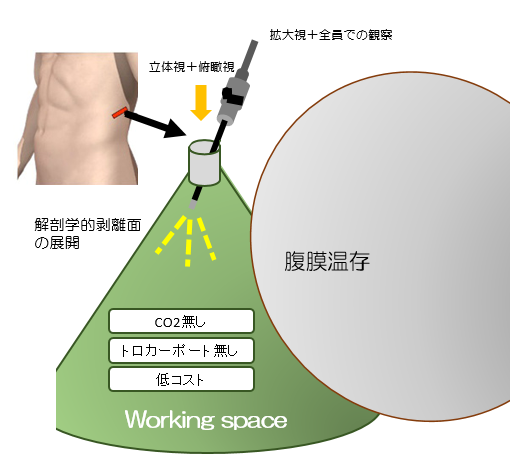 内視鏡イメージ