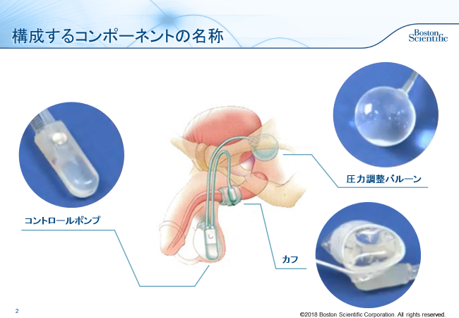 人工括約筋の画像