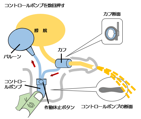 コントロールポンプを数回押す