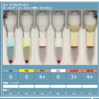 transfusion1.jpg transfusion1.jpg