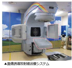 画像誘導放射線治療システム