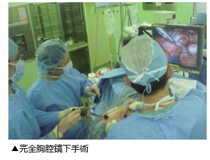 完全胸腔鏡下手術の画像