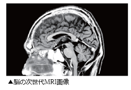 脳の次世代MRI画像