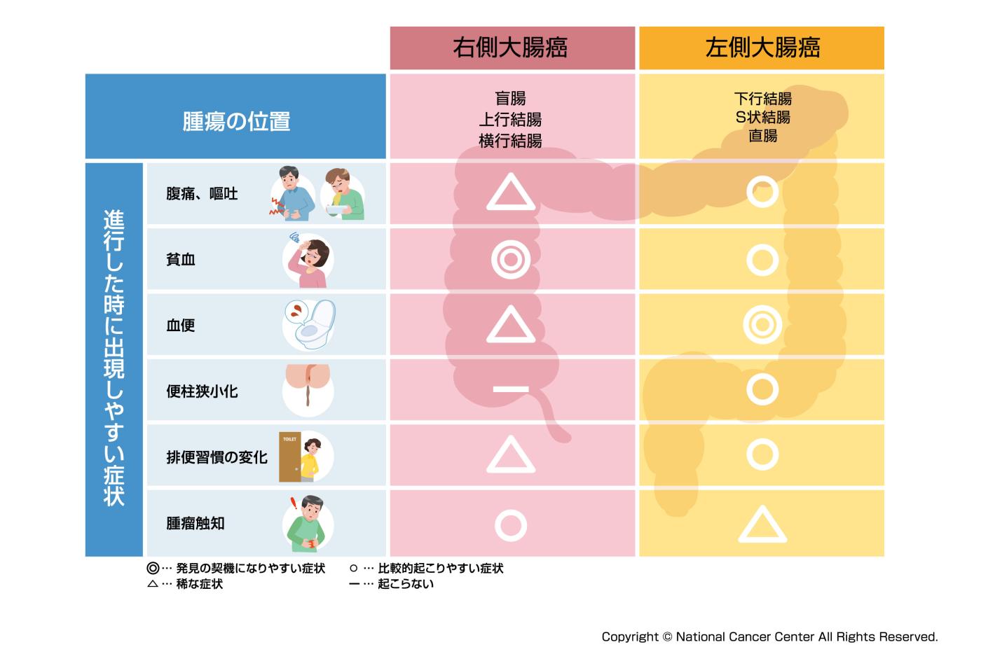 部位別にみる大腸がんの症状