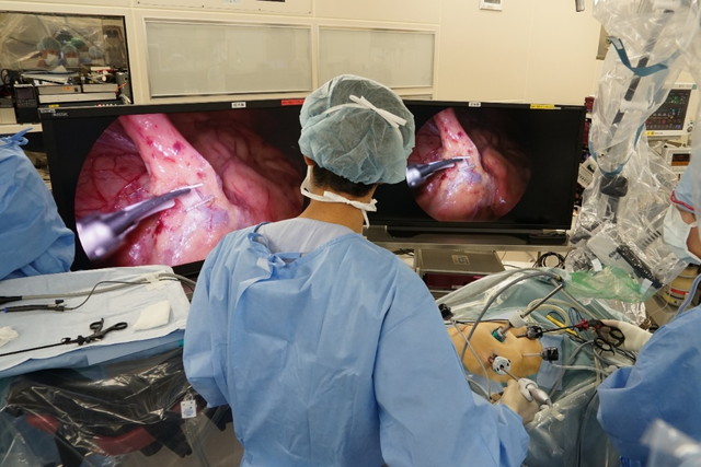 8K内視鏡手術システムを使用した手術の様子画像