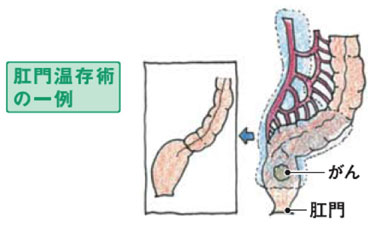 の画像