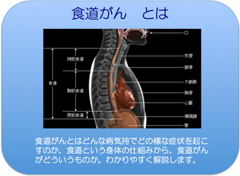 食道がんとは