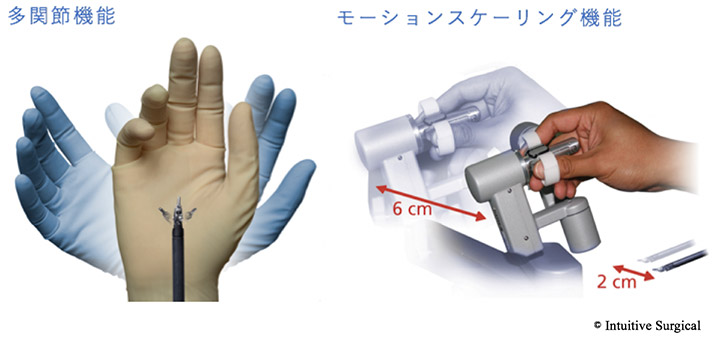 最新鋭機ダヴィンチXi　画像3