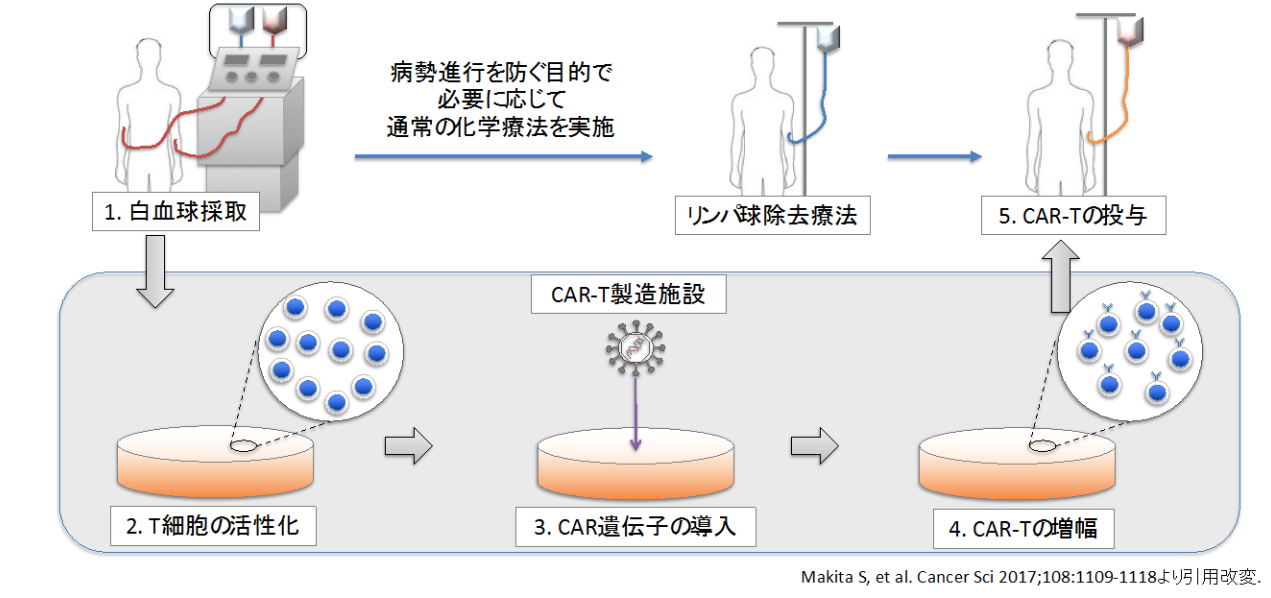 CAR-T療法の概略