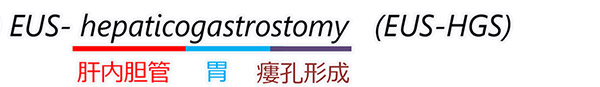 EUS-hepaticogastrostomy(EUS-HGS)