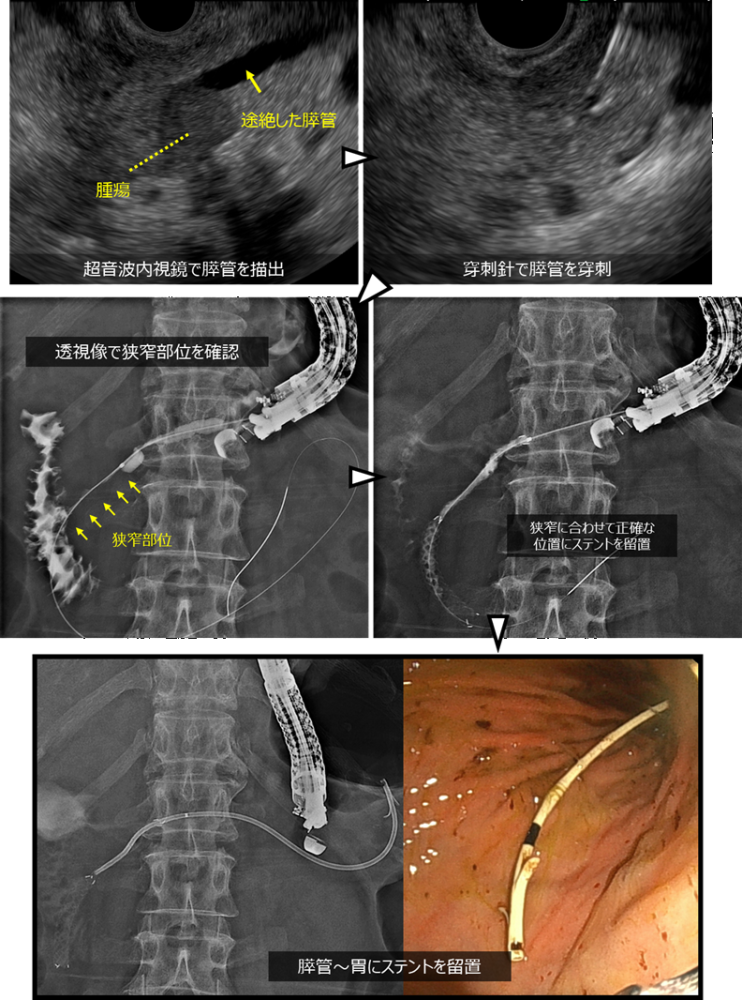 image06