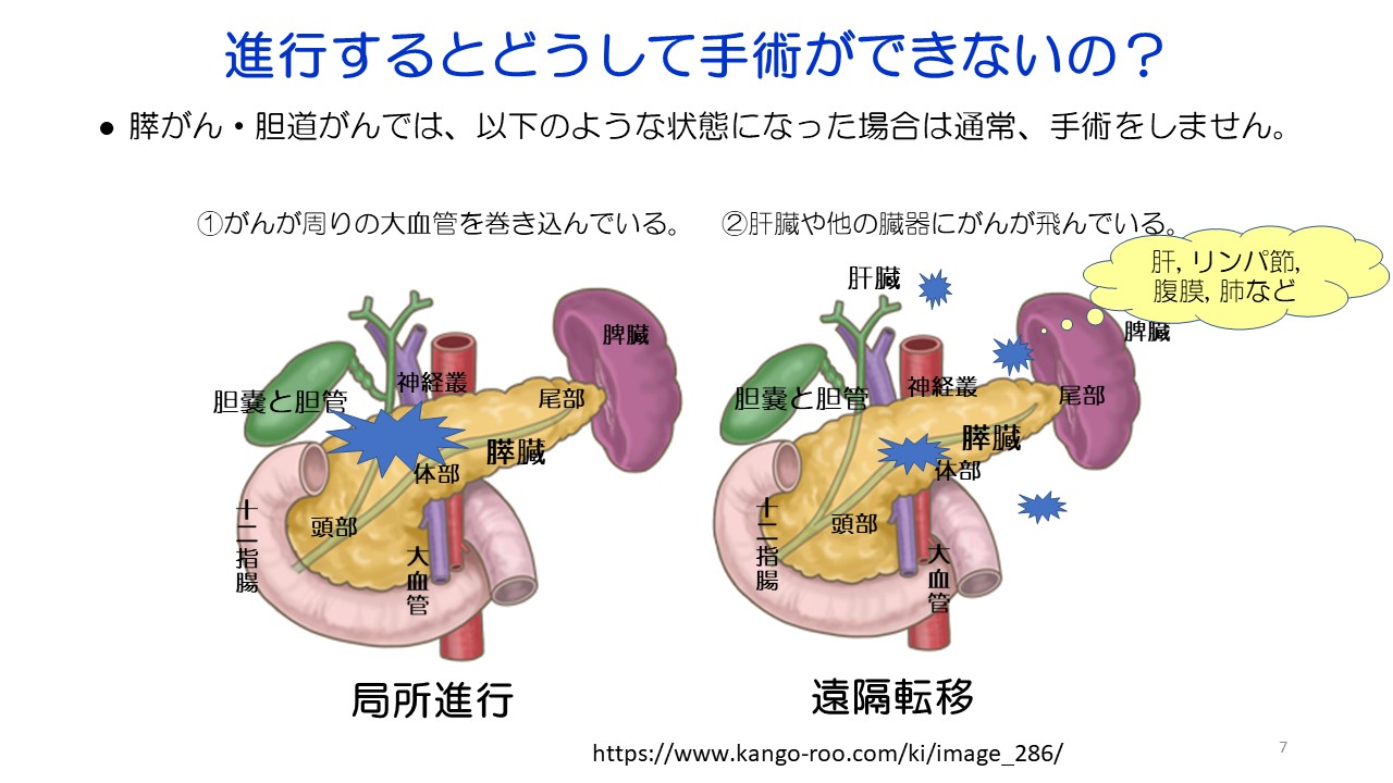膵がん・胆道がんの診断と治療スライド7