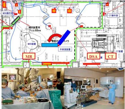 術中MRI・CT・DSAを利用した脳腫瘍摘出術