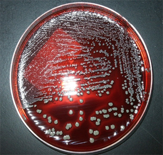 微生物検査_02