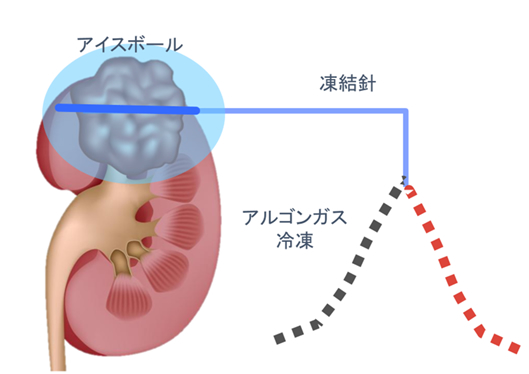 模式図