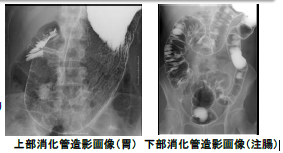 大腸CT検査風景画像