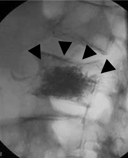 脳血管画像（MR Angiography）