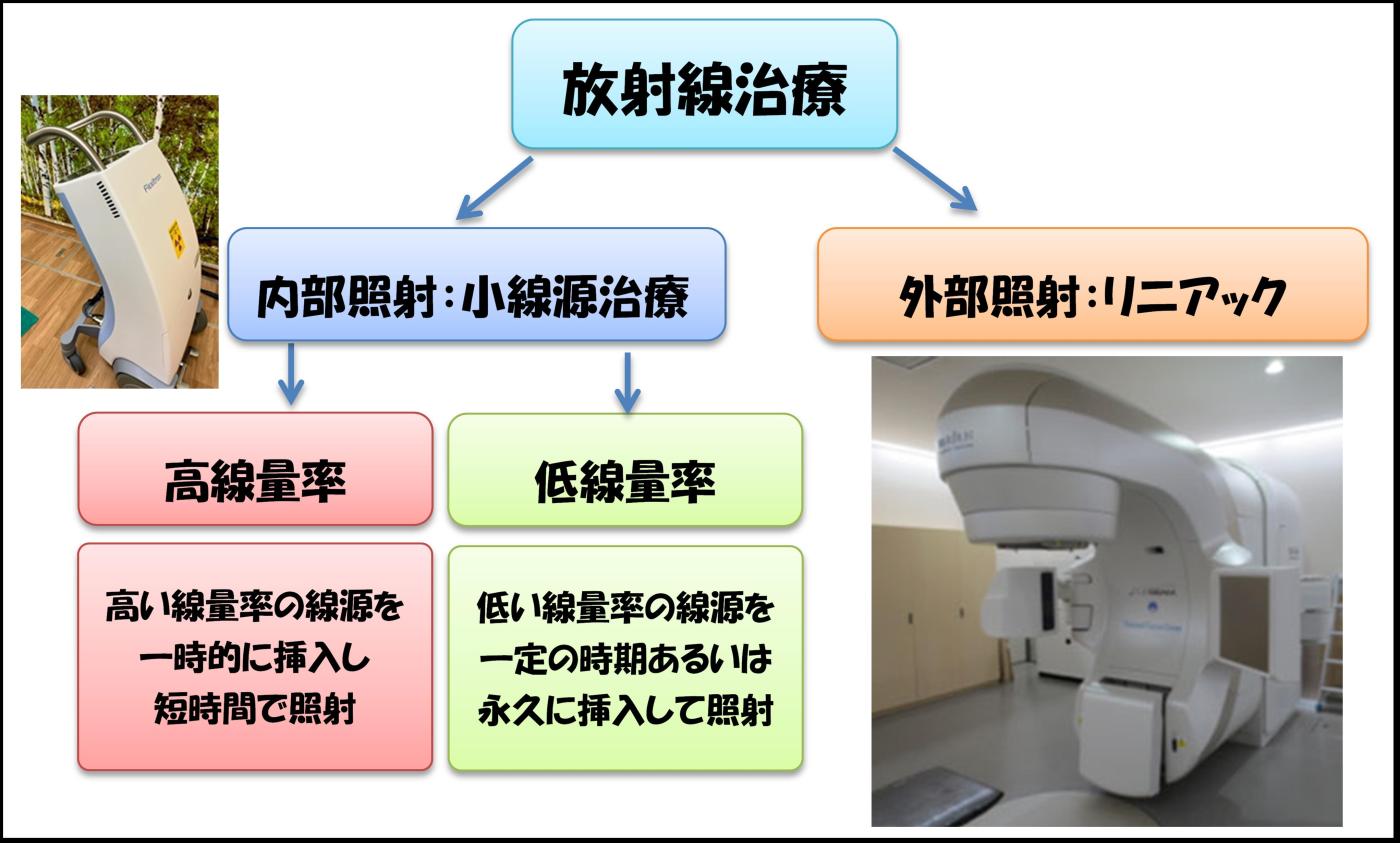 図1：放射線治療　内部照射と外部照射