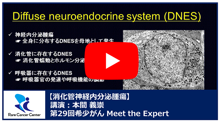 第29回消化管神経内分泌腫瘍講演:本間 義崇 第29回消化管神経内分泌腫瘍講演:本間 義崇