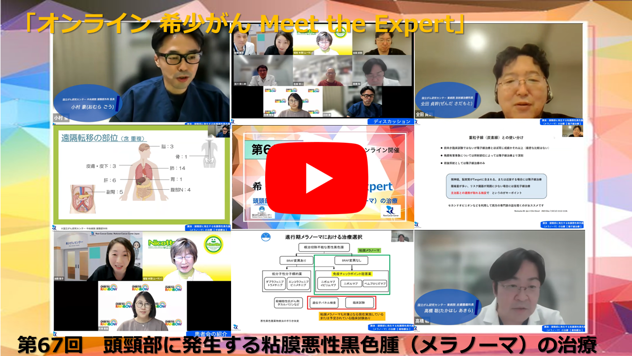 第67回 頭頸部に発生する粘膜悪性黒色腫(メラノーマ)の治療 「オンライン 希少がん Meet the Expert」