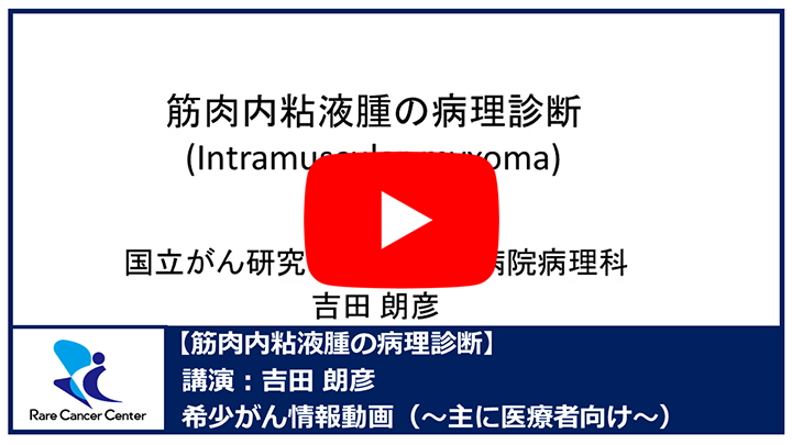 筋肉内粘液腫の病理診断：吉田朗彦