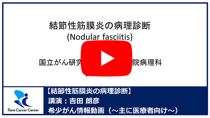 結節性筋膜炎の病理診断：吉田朗彦