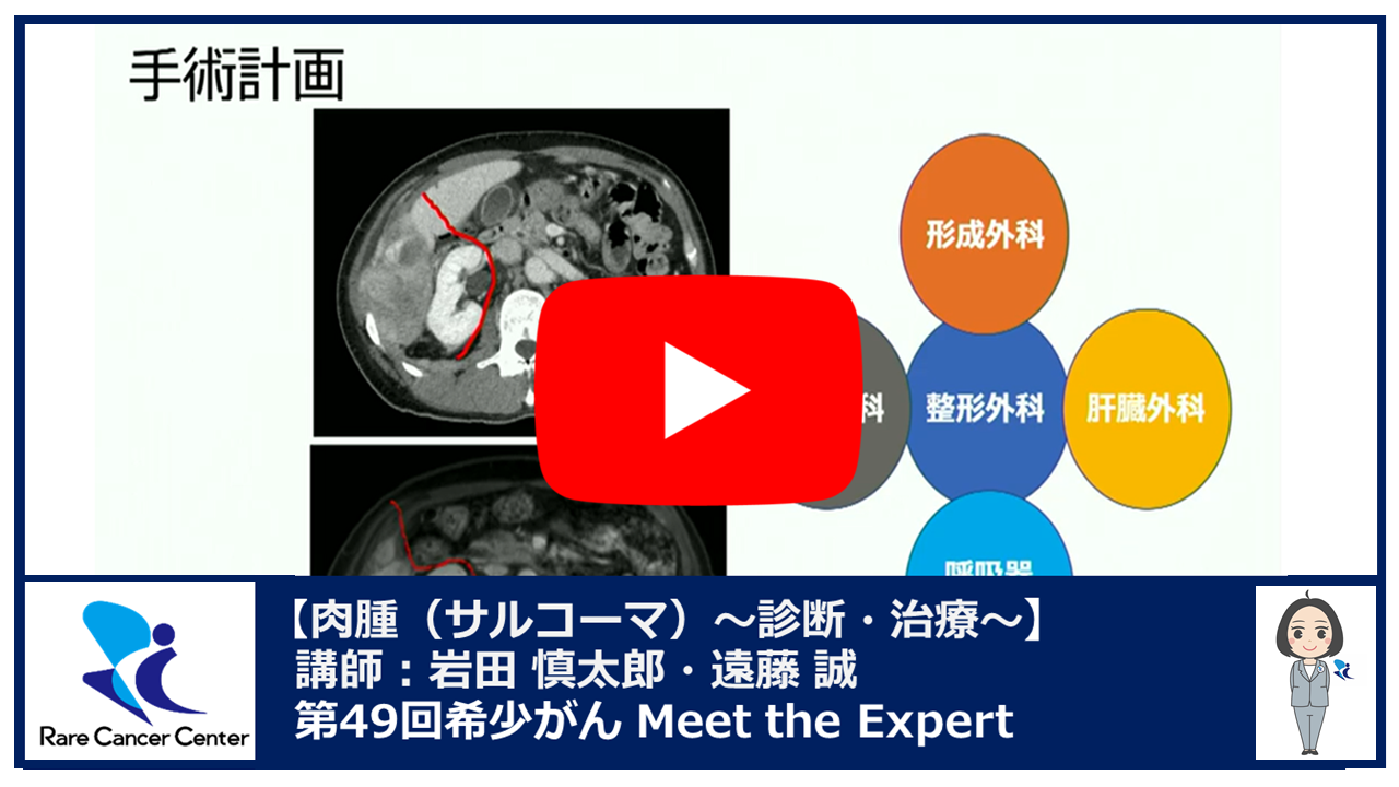 第49回肉腫(サルコーマ) 診断・治療 希少がんセンター×九州大学講演:岩田 慎太郎・遠藤 誠2