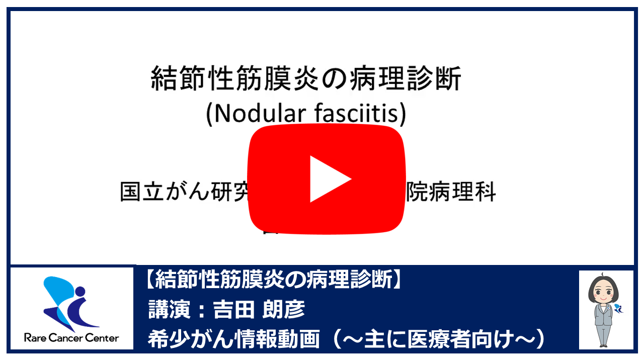 結節性筋膜炎の病理診断:吉田朗彦2