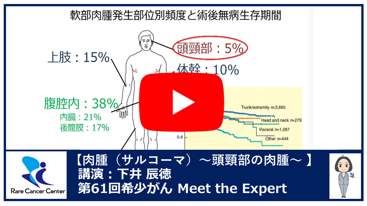 第61回 ~頭頸部の肉腫~下井 辰徳2