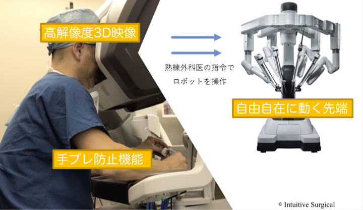ロボット手術のイメージ
