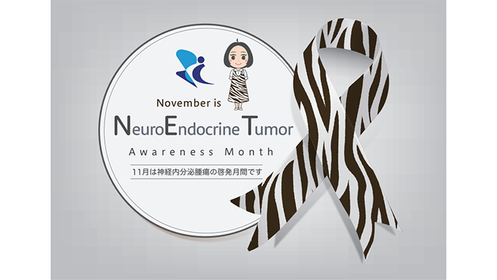 20210222neuroendocrine_tumor