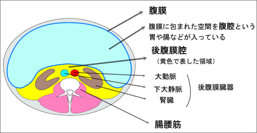 後腹膜の肉腫 希少がんセンター