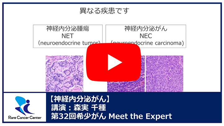 第32回神経内分泌がん講演：森実 千種