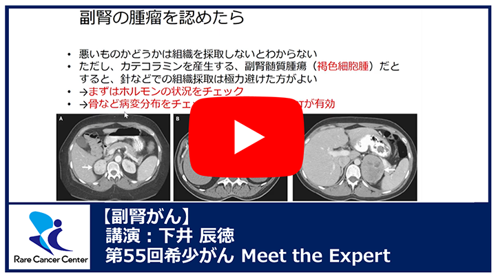 第55回胚細胞腫瘍講演：下井 辰徳 