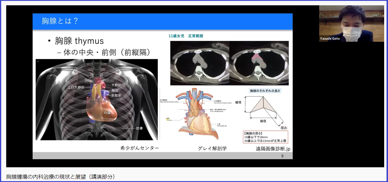 胸腺腫・胸腺がん患者会ふたつば