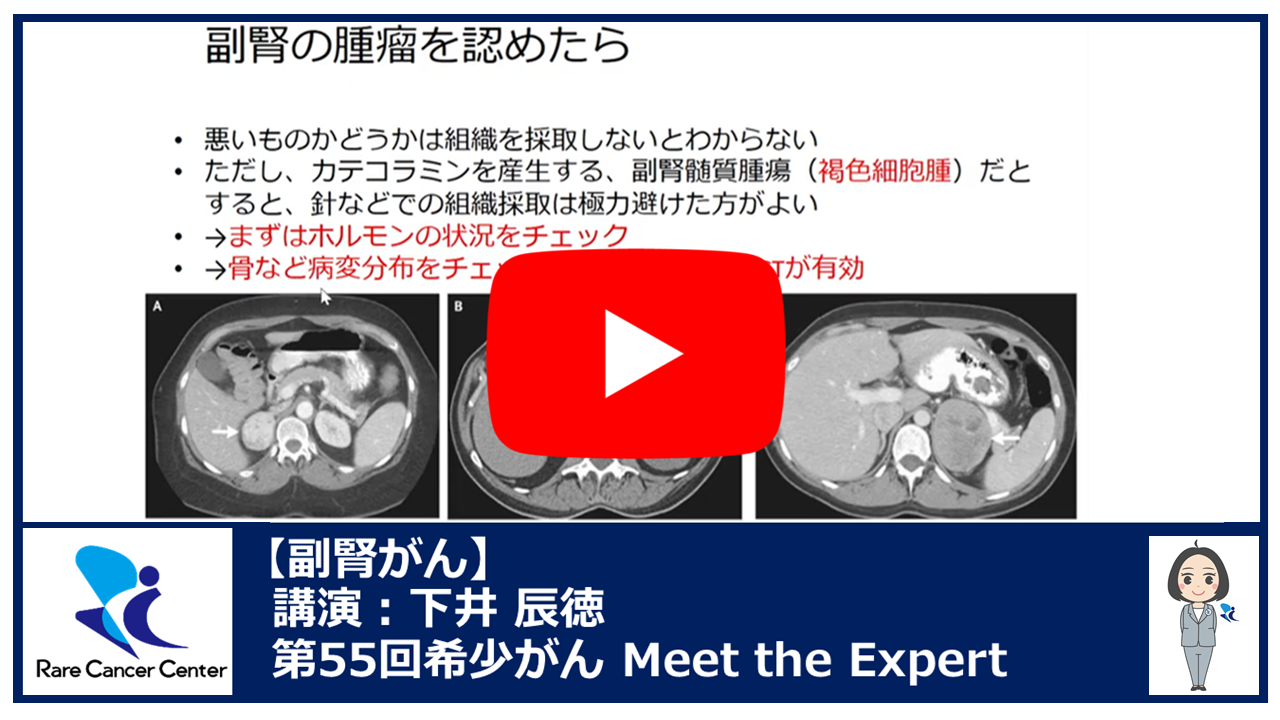 第55回副腎がん講演：下井 辰徳2