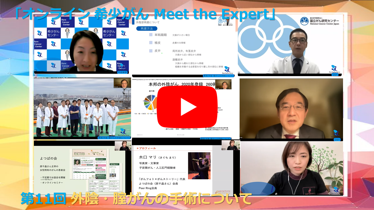 第11回 外陰・腟がんの手術について 「オンライン 希少がん Meet the Expert」