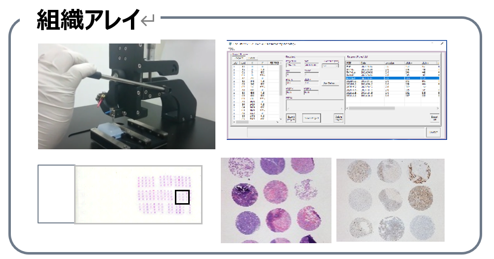 組織アレイ