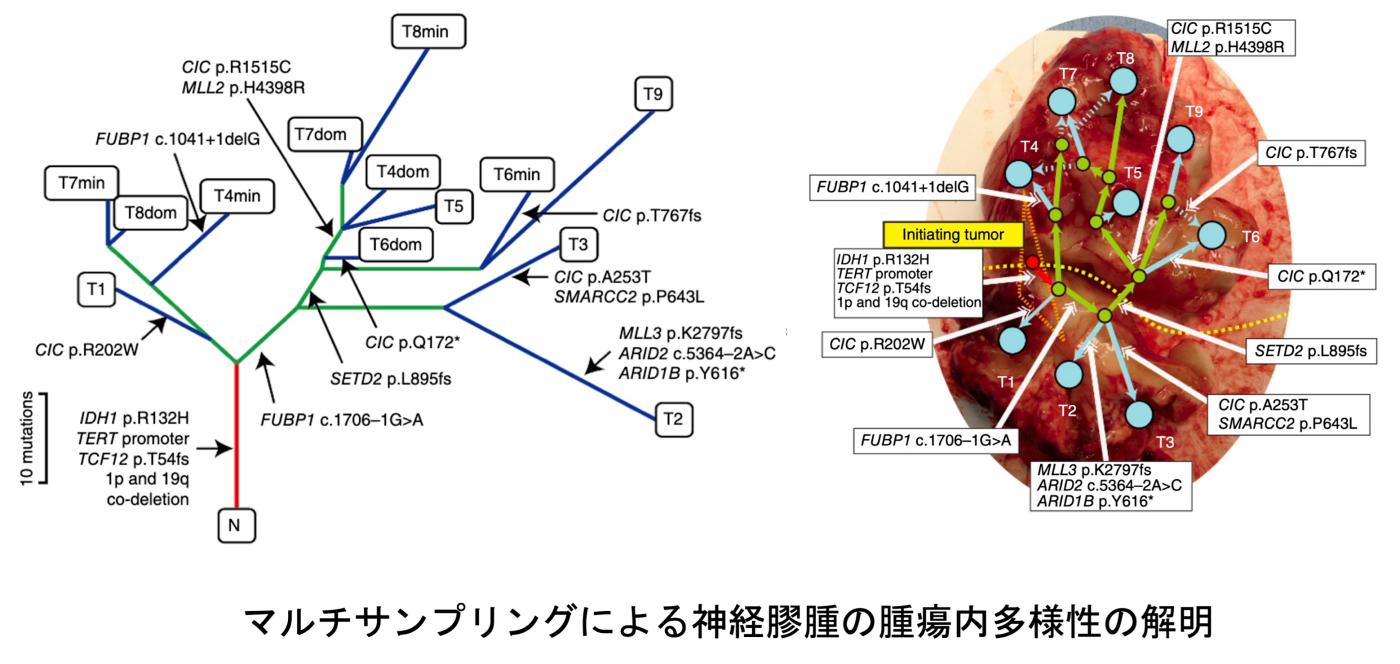 腫瘍内多様性