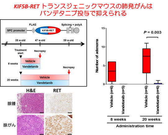 KIF5B-RET　トランスジェニックマウスの肺発がんはパンデタニブ投与で抑えられる