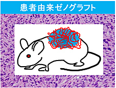 ゼノグラフト